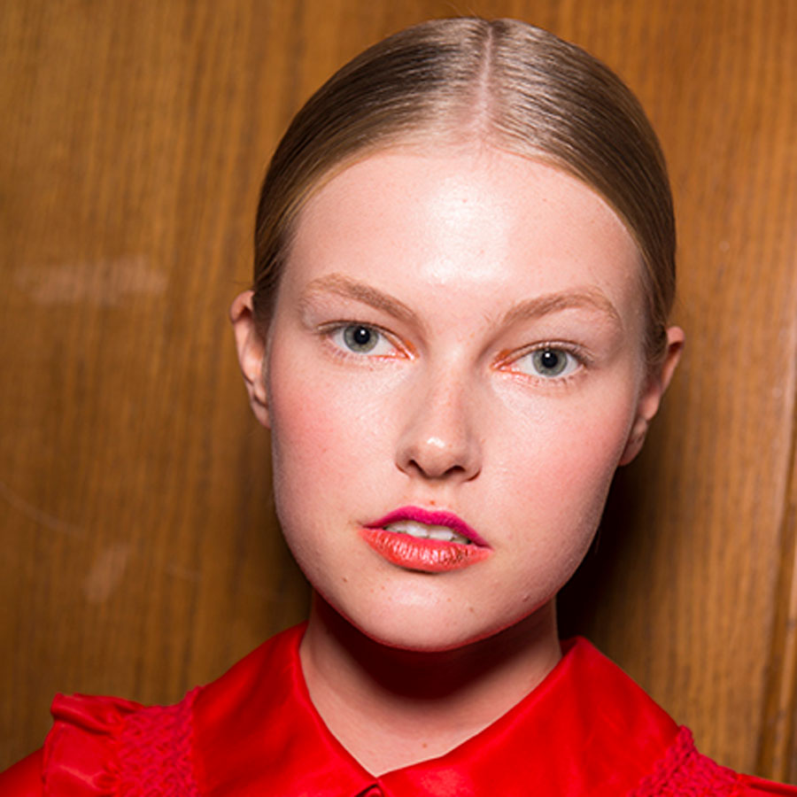 Everything You Need To Know About Acne And How To Treat It