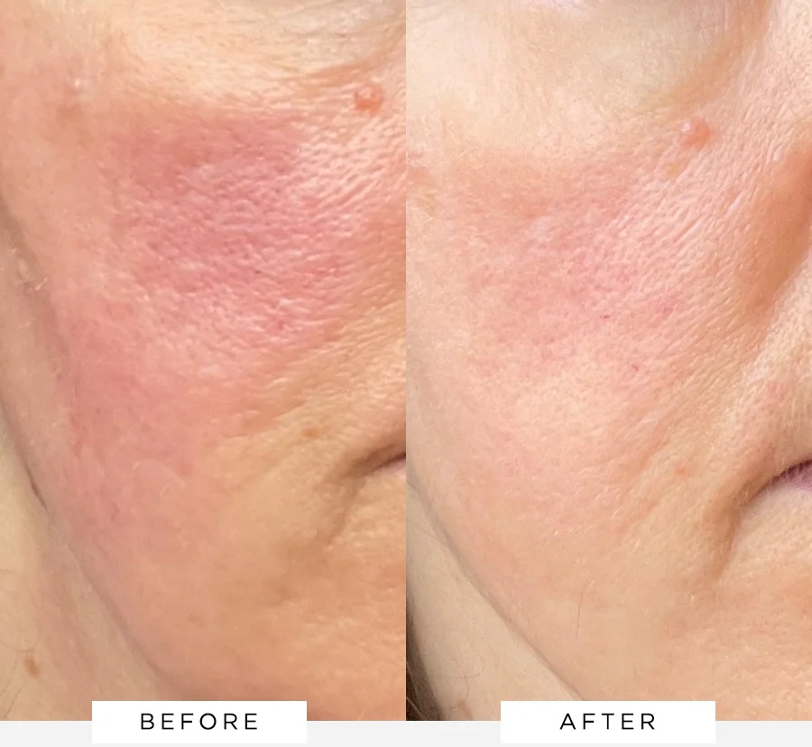 Flawless Brightly Serum