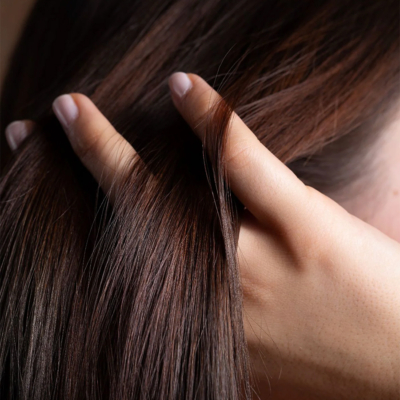 Hair Loss: The Silent Struggle of Menopause